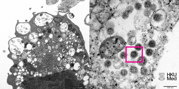 Ученым удалось сфотографировать штамм коронавируса Омикрон фото - Короновирус