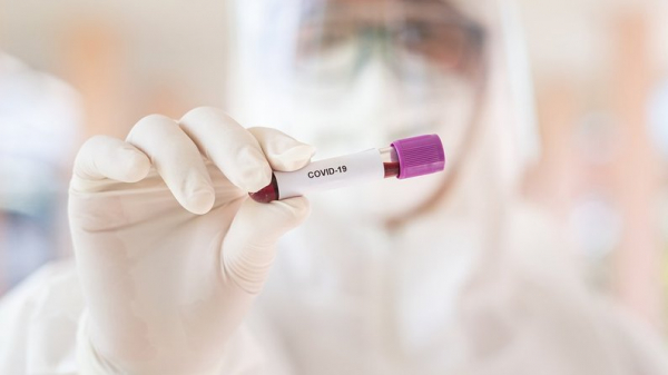 За тиждень у Нововолинській громаді на коронавірус захворіли 146 людей | Новини Нововолинська