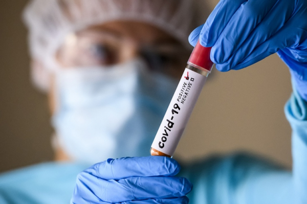 За тиждень у Нововолинській громаді на коронавірус захворіли 46 осіб, одна людина померла | Новини Нововолинська