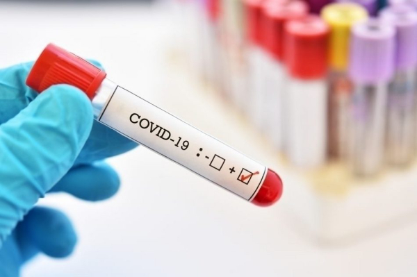 За тиждень у Нововолинській громаді на коронавірус захворіли п'ять осіб | Новини Нововолинська