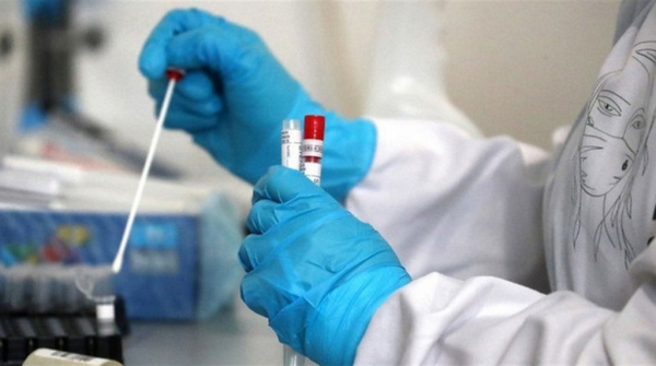 За тиждень у Нововолинській громаді на коронавірус захворіли 29 осіб | Новини Нововолинська