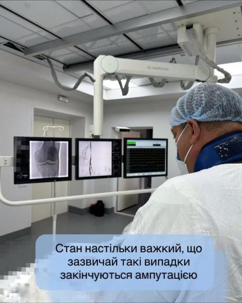 Кінцівка &laquo;ожила&raquo; на операційному столі: у Нововолинську медики врятували ногу пацієнта від ампутації | Новини Нововолинська
